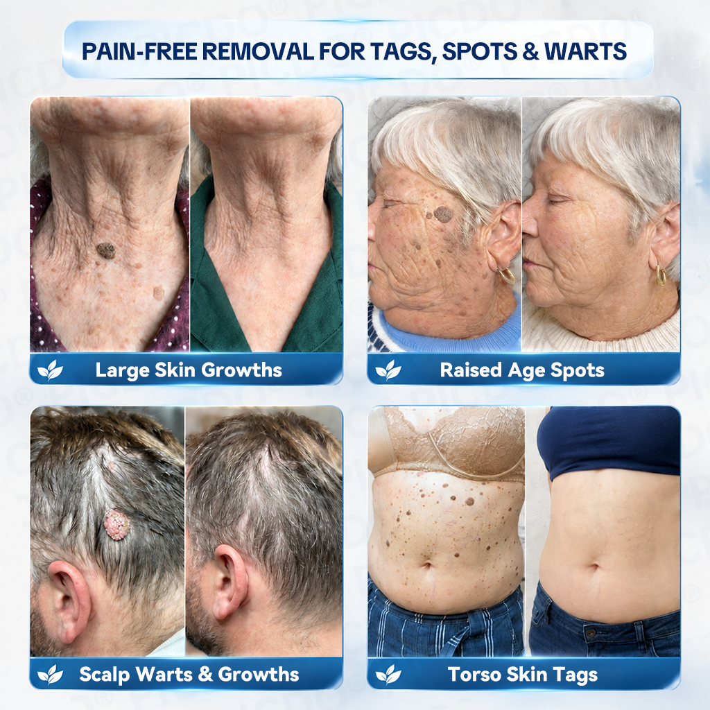 𝐏𝐢𝐜𝐝𝐨® 𝐌𝐚𝐠𝐧𝐞𝐬𝐢𝐮𝐦 𝐑𝐞𝐩𝐚𝐢𝐫 𝐂𝐫𝐞𝐚𝐦 (Zero Pain, Zero 𝐒𝐜𝐚𝐫𝐬 Formula) 🌹