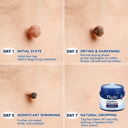 𝐏𝐢𝐜𝐝𝐨® 𝐌𝐚𝐠𝐧𝐞𝐬𝐢𝐮𝐦 𝐑𝐞𝐩𝐚𝐢𝐫 𝐂𝐫𝐞𝐚𝐦 (Zero Pain, Zero 𝐒𝐜𝐚𝐫𝐬 Formula) 🌹
