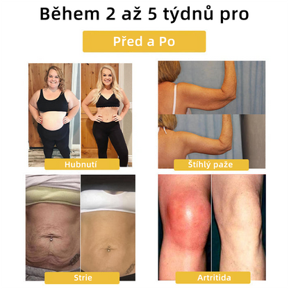 𝘾𝙕𝙏𝙄𝘾𝙇𝙀®Last day of the promotion — 50% OFF🔥𝗠𝗼𝗶𝘀𝘀𝗮𝗻𝗶𝘁𝗲 𝗠𝗮𝗴𝗻𝗲𝘁𝗼𝘁𝗵𝗲𝗿𝗮𝗽𝘆 𝗗𝗶𝗮𝗺𝗼𝗻𝗱 𝗥𝗶𝗻𝗴 🌹