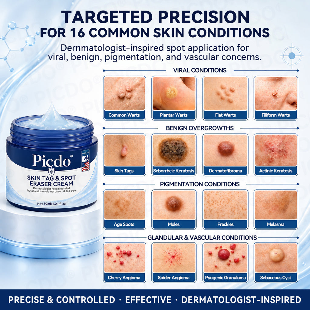 𝐏𝐢𝐜𝐝𝐨®💦7-𝐃𝐚𝐲 𝐒𝐤𝐢𝐧 𝐓𝐚𝐠 & 𝐒𝐩𝐨𝐭 𝐄𝐫𝐚𝐬𝐞𝐫 𝐂𝐫𝐞𝐚𝐦(Zero Pain, Zero 𝐒𝐜𝐚𝐫𝐬 Formula)🌺