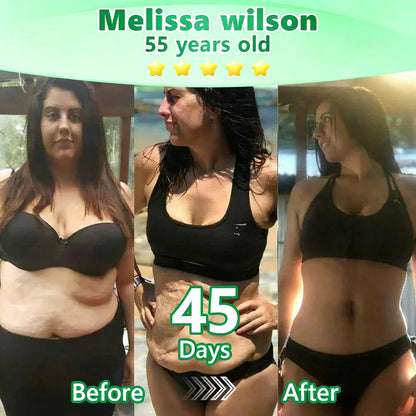 𝑶𝒇𝒇𝒊𝒄𝒊𝒂𝒍 𝑺𝒕𝒐𝒓𝒆  | 👩‍⚕️ 𝑳𝒖𝒙𝒂𝒓𝒊𝒔𝒆® 𝑴𝒐𝒓𝒊𝒏𝒈𝒂 & 𝑩𝒆𝒓𝒃𝒆𝒓𝒊𝒏𝒆 10-𝑰𝑵-1 𝑨𝒅𝒗𝒂𝒏𝒄𝒆𝒅 𝑵𝒂𝒏𝒐 𝑴𝒊𝒄𝒓𝒐𝒏𝒆𝒆𝒅𝒍𝒆 𝑷𝒂𝒕𝒄𝒉 (𝐎𝐧𝐜𝐞 𝐃𝐚𝐢𝐥𝐲, 𝐯𝐢𝐬𝐢𝐛𝐥𝐞 𝐜𝐡𝐚𝐧𝐠𝐞𝐬 𝐢𝐧 𝟕 𝐝𝐚𝐲𝐬）✅ 𝐎𝐛𝐞𝐬𝐢𝐭𝐲, 𝐃𝐢𝐚𝐛𝐞𝐭𝐞𝐬, 𝐒𝐥𝐞𝐞𝐩 𝐀𝐩𝐧𝐞𝐚, 𝐀𝐧𝐝 𝐉𝐨𝐢𝐧𝐭 𝐈𝐬𝐬𝐮𝐞𝐬 🌹🌹🌹