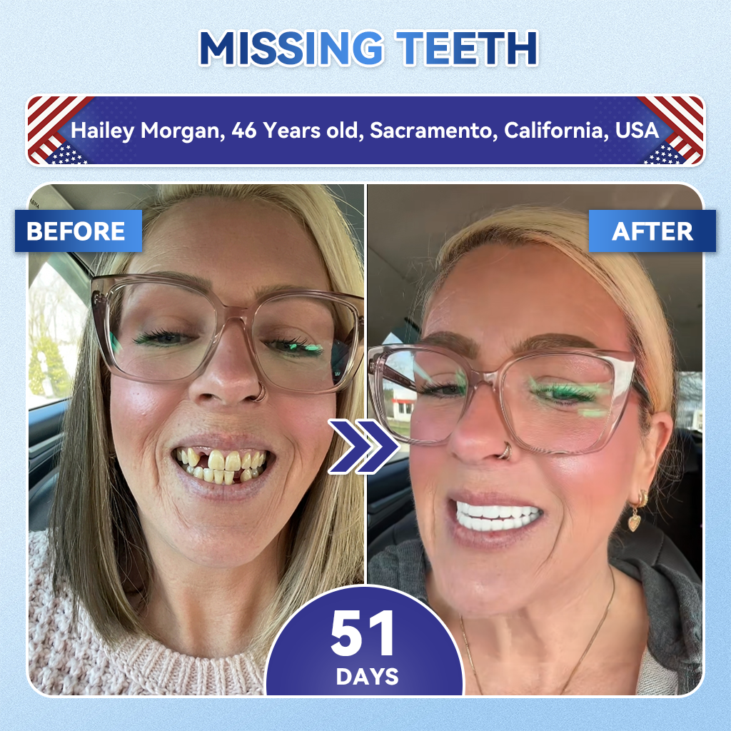 𝐆𝐥𝐢𝐦𝐦𝐞𝐫𝐥𝐲® 𝐓𝐢𝐝𝐞𝐠𝐥𝐮𝐬𝐢𝐛 𝐓𝐨𝐨𝐭𝐡 & 𝐆𝐮𝐦 𝐑𝐞𝐩𝐚𝐢𝐫 𝐌𝐢𝐜𝐫𝐨𝐧𝐞𝐞𝐝𝐥𝐞 𝐏𝐚𝐭𝐜𝐡  | 𝐀𝐝𝐯𝐚𝐧𝐜𝐞𝐝 𝐒𝐭𝐞𝐦-𝐂𝐞𝐥𝐥 𝐀𝐜𝐭𝐢𝐯𝐚𝐭𝐢𝐨𝐧 𝐓𝐞𝐞𝐭𝐡 𝐒𝐭𝐫𝐢𝐩𝐬(🦷𝐑𝐞𝐛𝐮𝐢𝐥𝐝 𝐄𝐧𝐚𝐦𝐞𝐥 & 𝐃𝐞𝐧𝐭𝐢𝐧 • 𝐒𝐭𝐫𝐞𝐧𝐠𝐭𝐡𝐞𝐧 𝐆𝐮𝐦𝐬 • 𝐄𝐫𝐚𝐝𝐢𝐜𝐚𝐭𝐞 𝐓𝐚𝐫𝐭𝐚𝐫 & 𝐎𝐝𝐨𝐫 • 𝐒𝐭𝐨𝐩 𝐓𝐨𝐨𝐭𝐡 𝐒𝐞𝐧𝐬𝐢𝐭𝐢𝐯𝐢𝐭𝐲) 🌹🌹